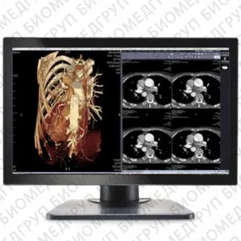 Double Black Imaging Image Systems Gemini 4MP Large Format Display Медицинский монитор