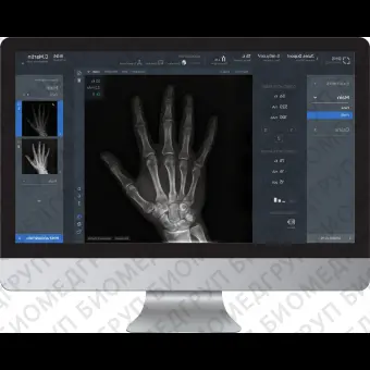 Программное обеспечение рентгенографии ADAM