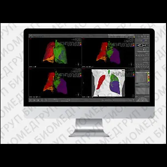 Модуль программного обеспечения для рентгенологии Myrian XPLung