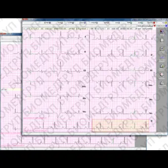 Программное обеспечение для электрокардиографии CVS03