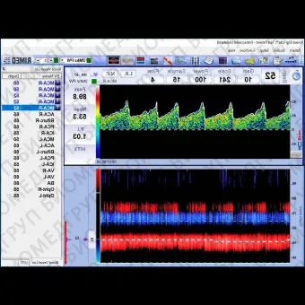 Трансчерепной доплер DigiLite