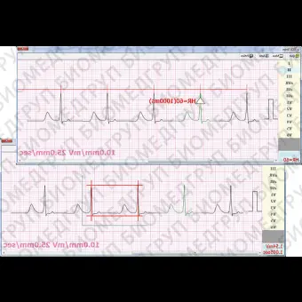 Программное обеспечение для электрокардиографии CVS03