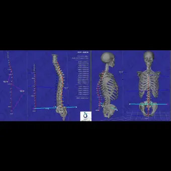 Система оценки осанки 3D B.A.K. Body Analysis Kapture