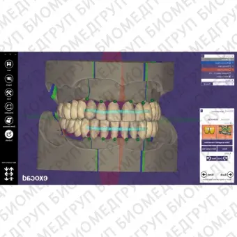 Exocad Full Denture Module  модуль для создания полносъемных протезов