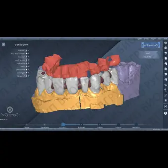 Программное обеспечение для лабораторий DentalCad