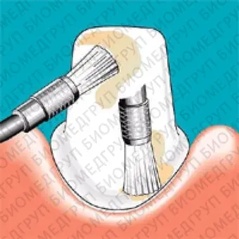 Sonicflex clean brush 2  насадкащетка плоская большая для чистки зубов